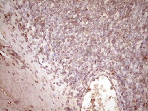 m02965 1 anti plat mouse monoclonal antibody clone id oti3h3 ihc testing 7