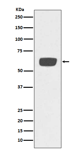 Western blot analysis of PLAT expression in human plasma lysate