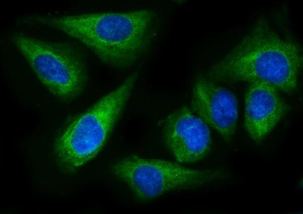 m02967 eprs1 primary antibodies if testing 3