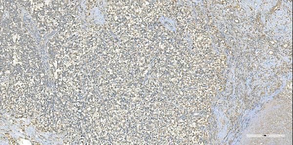 m02967 eprs1 primary antibodies ihc testing 2