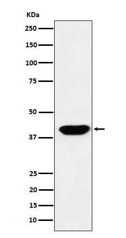 Western blot analysis of Islet1 expression in HeLa cell lysate