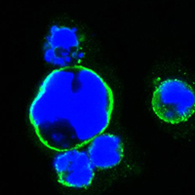 Immunofluorescent staining data of ISL1 using Anti-Islet-1 ISL1 Monoclonal Antibody (M02969-2)