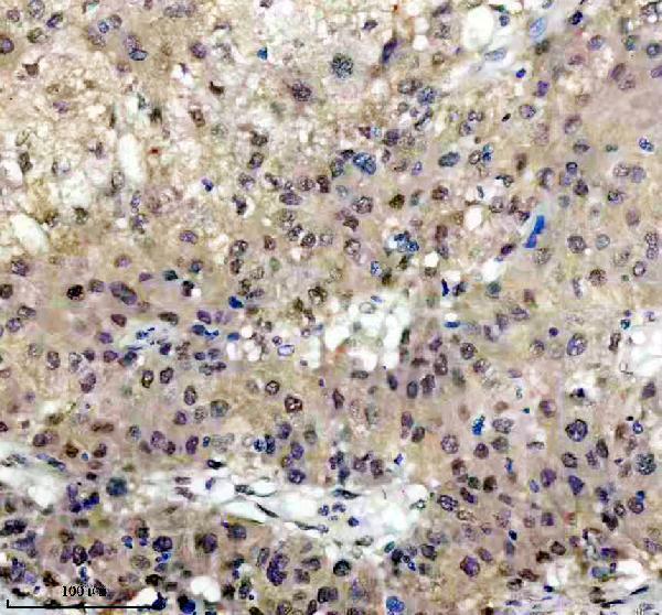 IHC analysis of ISL1 using anti-ISL1 antibody (M02969)