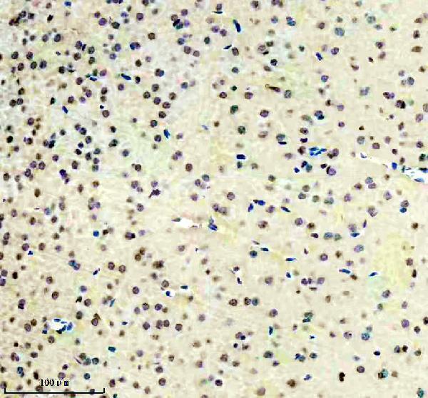 IHC analysis of ISL1 using anti-ISL1 antibody (M02969)