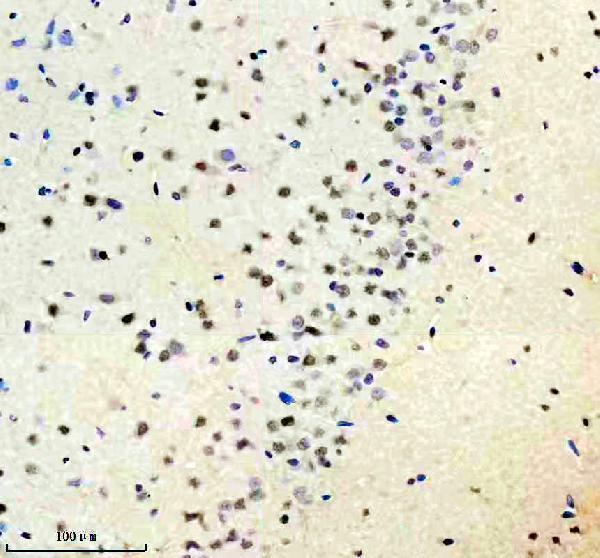 m02969 isl1 primary antibodies ihc testing 3