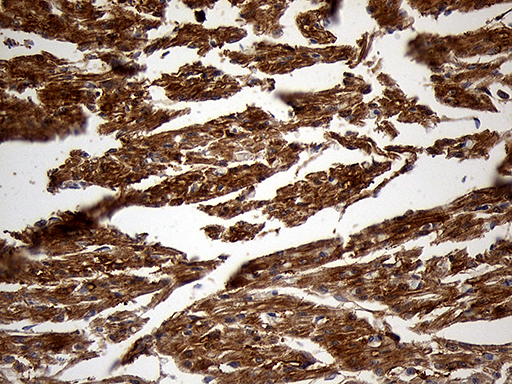 m02971 anti pygm mouse monoclonal antibody clone id oti5d1 ihc testing 3