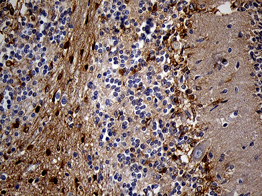 m02971 anti pygm mouse monoclonal antibody clone id oti5d1 ihc testing 5