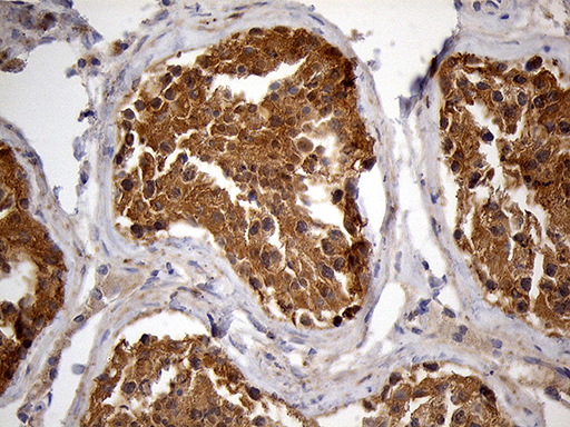 m02971 anti pygm mouse monoclonal antibody clone id oti5d1 ihc testing 6