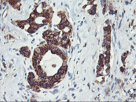 m02975 1 anti golph2 golm1 mouse monoclonal antibody clone id oti2d6 ihc testing 2