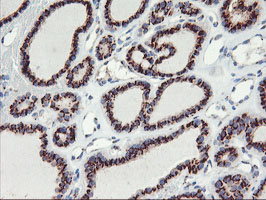 m02975 1 anti golph2 golm1 mouse monoclonal antibody clone id oti2d6 ihc testing 3