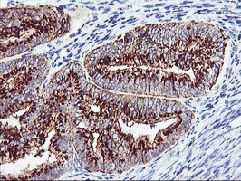 m02975 1 anti golph2 golm1 mouse monoclonal antibody clone id oti2d6 ihc testing 4
