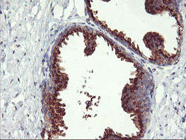 m02975 1 anti golph2 golm1 mouse monoclonal antibody clone id oti2d6 ihc testing 5