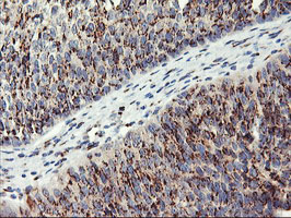 m02975 1 anti golph2 golm1 mouse monoclonal antibody clone id oti2d6 ihc testing 6