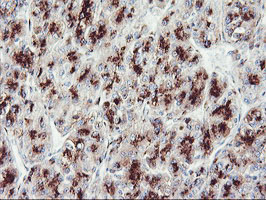 m02975 1 anti golph2 golm1 mouse monoclonal antibody clone id oti2d6 ihc testing 7