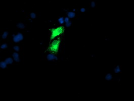 m02975 2 anti golph2 golm1 mouse monoclonal antibody clone id oti4b12 if testing 10