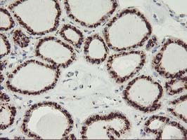 m02975 2 anti golph2 golm1 mouse monoclonal antibody clone id oti4b12 ihc testing 3