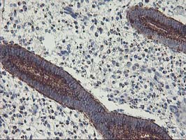 m02975 2 anti golph2 golm1 mouse monoclonal antibody clone id oti4b12 ihc testing 4