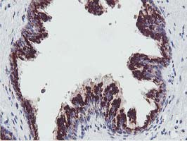 m02975 2 anti golph2 golm1 mouse monoclonal antibody clone id oti4b12 ihc testing 5