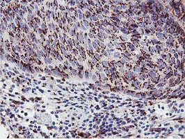 m02975 2 anti golph2 golm1 mouse monoclonal antibody clone id oti4b12 ihc testing 6