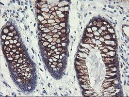 m02975 2 anti golph2 golm1 mouse monoclonal antibody clone id oti4b12 ihc testing 7