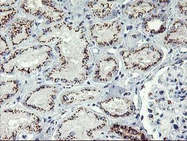 m02975 2 anti golph2 golm1 mouse monoclonal antibody clone id oti4b12 ihc testing 8