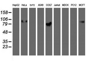m02975 2 anti golph2 golm1 mouse monoclonal antibody clone id oti4b12 wb testing 2