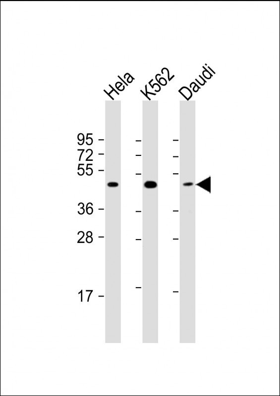 All lanes : Anti-PLIN3 Antibody at 1:2000 dilutionLane 1: Hela whole cell lysateLane 2: K562 whole cell lysateLane 3: Daudi whole cell lysateLysates/proteins at 20 µg per lane