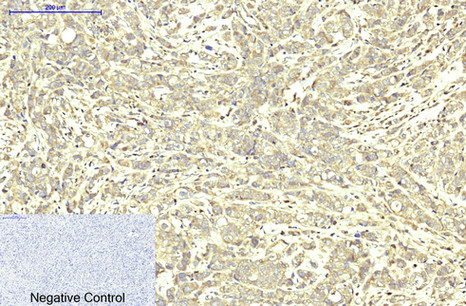 m02979 abcb5 primary antibodies ihc testing 3