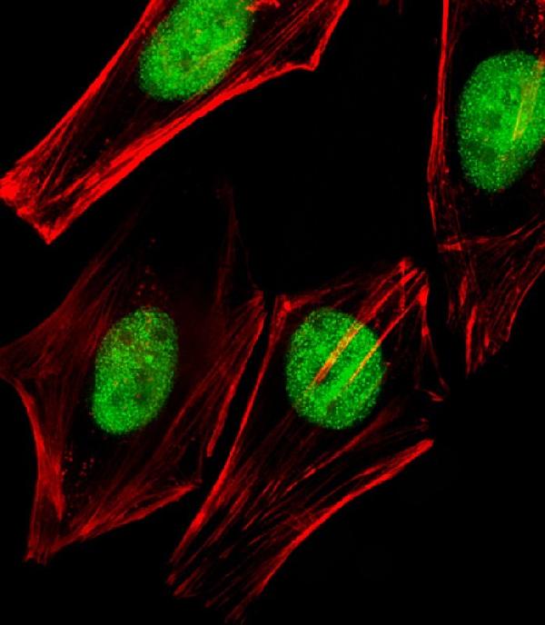 Immunofluorescent analysis of 4% paraformaldehyde-fixed, 0.1% Triton X-100 permeabilized HeLa (human cervical epithelial adenocarcinoma cell line) cells labeling TRRAP with M02981 at 1/25 dilution, followed by Dylight® 488-conjugated goat anti-rabbit IgG secondary antibody at 1/200 dilution (green). Immunofluorescence image showing nucleus staining on HeLa cell line. Cytoplasmic actin is detected with Dylight® 554 Phalloidin at 1/100 dilution (red).