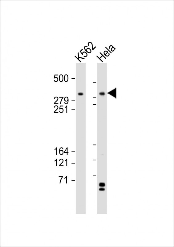 All lanes : Anti-TRRAP Antibody (C-term) at 1:2000 dilution Lane 1: K562 whole cell lysates Lane 2: Hela whole cell lysates Lysates/proteins at 20 microg per lane. Secondary Goat Anti-Rabbit IgG, (H+L), Peroxidase conjugated at 1/10000 dilution. Predicted band size : 438 kDa Blocking/Dilution buffer: 5% NFDM/TBST. All lanes : Anti-TRRAP Antibody (C-term) at 1:2000 dilution Lane 1: K562 whole cell lysates Lane 2: Hela whole cell lysates Lysates/proteins at 20 microg per lane. Secondary Goat Anti-Rabbit IgG, (H+L), Peroxidase conjugated at 1/10000 dilution. Predicted band size : 438 kDa Blocking/Dilution buffer: 5% NFDM/TBST.