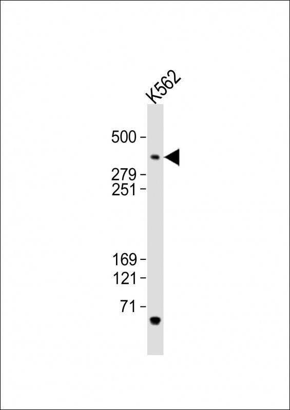 Anti-TRRAP Antibody (C-term)at 1:2000 dilution + K562 whole cell lysates Lysates/proteins at 20 microg per lane. Secondary Goat Anti-Rabbit IgG, (H+L), Peroxidase conjugated at 1/10000 dilution. Predicted band size : 438 kDa Blocking/Dilution buffer: 5% NFDM/TBST. Anti-TRRAP Antibody (C-term)at 1:2000 dilution + K562 whole cell lysates Lysates/proteins at 20 microg per lane. Secondary Goat Anti-Rabbit IgG, (H+L), Peroxidase conjugated at 1/10000 dilution. Predicted band size : 438 kDa Blocking/Dilution buffer: 5% NFDM/TBST.