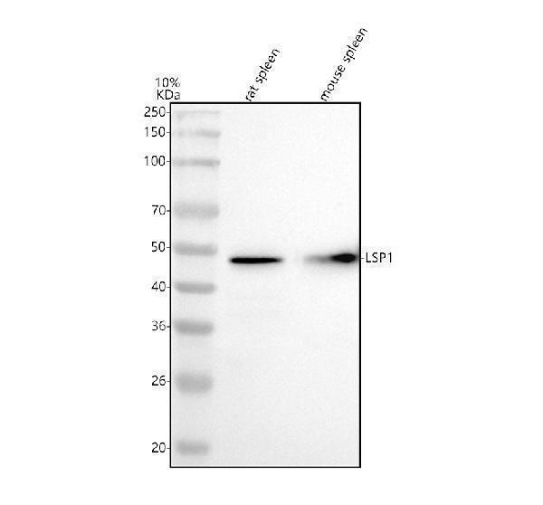  Western blot analysis of LSP1 using anti-LSP1 antibody (M02992)