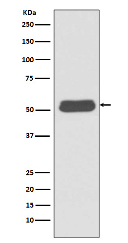 Western blot analysis of LSP1 expression in Ramos cell lysate