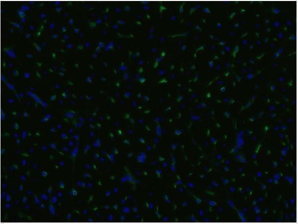 Immunocytochemistry staining of an infarcted porcine heart with anti-CD105 (MEM-229; green); cell nuclei stained with DAPI (blue)