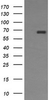 HEK293T cells were transfected with the pCMV6-ENTRY control (Left lane) or pCMV6-ENTRY ENG (Right lane) cDNA for 48 hrs and lysed
