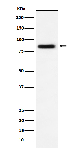 Western blot analysis of CD105 expression in HUVEC cell lysate