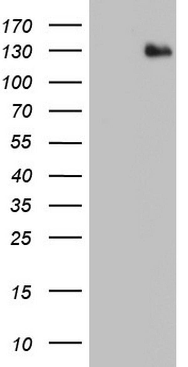 HEK293T cells were transfected with the pCMV6-ENTRY control (Left lane) or pCMV6-ENTRY ADAMTS1 (Right lane) cDNA for 48 hrs and lysed