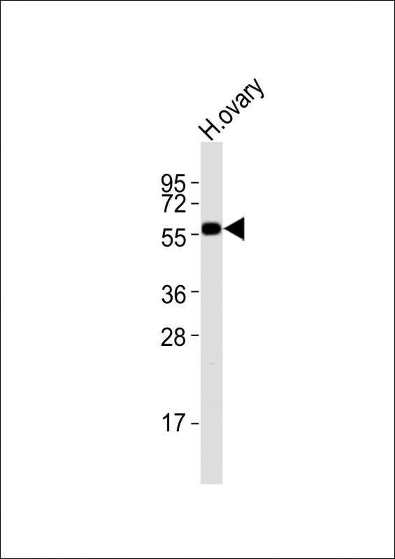 Anti-DRD5 Antibody (C-term)at 1:2000 dilution + human ovary lysatesLysates/proteins at 20 µg per lane
