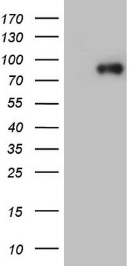 HEK293T cells were transfected with the pCMV6-ENTRY control (Left lane) or pCMV6-ENTRY YME1L1 (Right lane) cDNA for 48 hrs and lysed