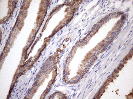 m03015 1 anti egln2 mouse monoclonal antibody clone id oti7h3 ihc testing 6