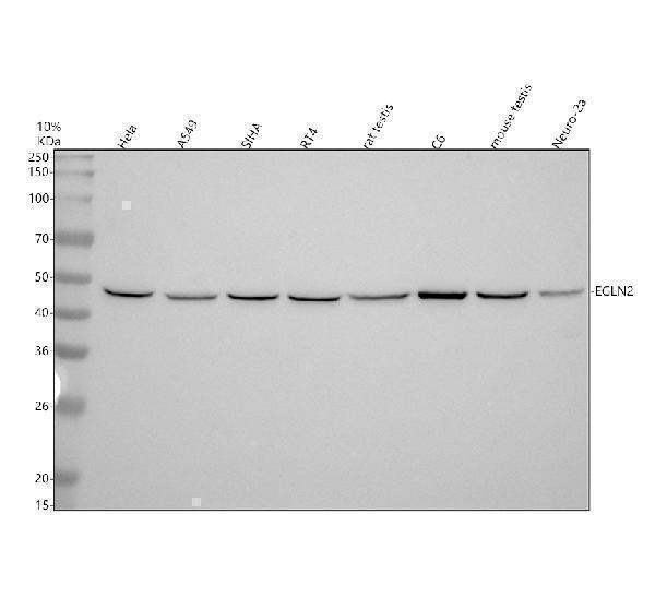 Western blot analysis of PHD1/EGLN2 using anti-PHD1/EGLN2 antibody (M03015)