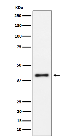 Western blot analysis of IL15RA expression in Raji cell lysate