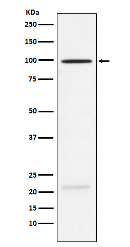 Western blot analysis of MAG expression in Rat brain lysate