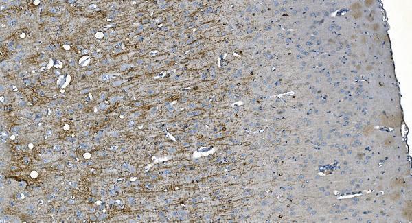 m03019 mag primary antibodies ihc testing 3