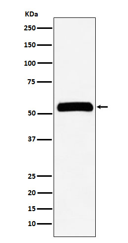 Western blot analysis of IMPDH2 expression in HeLa cell lysate
