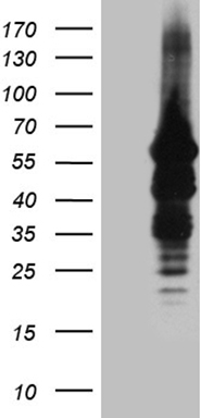 HEK293T cells were transfected with the pCMV6-ENTRY control (Left lane) or pCMV6-ENTRY IMPDH2 (Right lane) cDNA for 48 hrs and lysed
