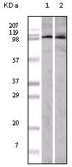 Western Blot analysis using EphA1 Monoclonal Antibody against A549 (1) and HeLa (2) cell lysate