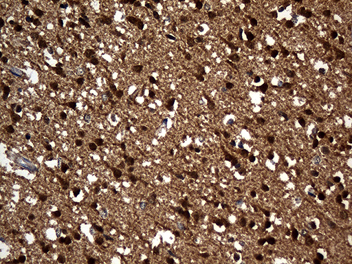 Immunohistochemical staining of paraffin-embedded Human adult brain tissue within the normal limits using anti-PPP3CA mouse monoclonal antibody