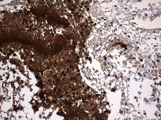 Immunohistochemical staining of paraffin-embedded Human embryonic cerebellum within the normal limits using anti-PPP3CA mouse monoclonal antibody