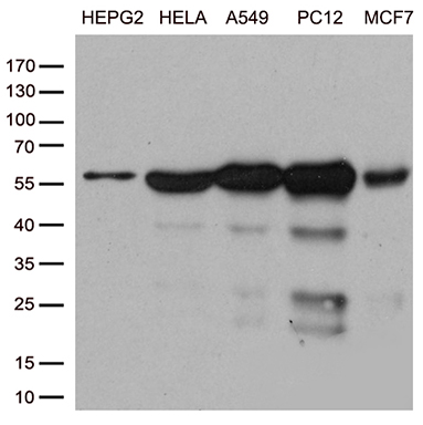 Western blot analysis of extracts (35ug) from cell lines by using anti-PPP3CA monoclonal antibody (1:500)